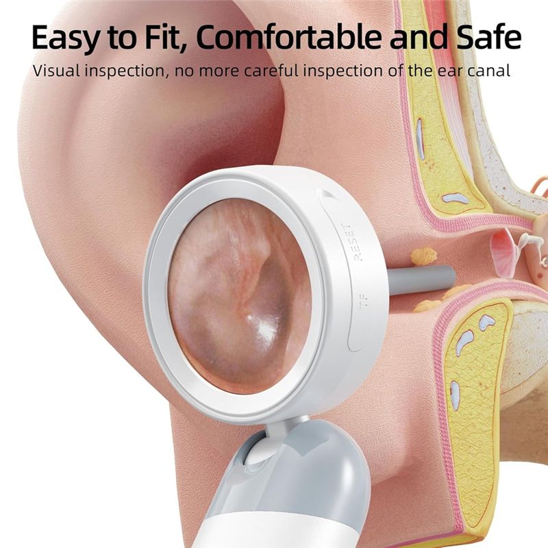 LXYB18B Wireless Ear Otoscope  - Photography Lighting Products 评论和价格