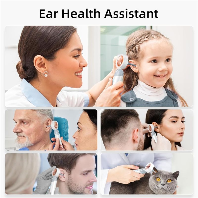 LXYB18B Wireless Ear Otoscope  - Photography Lighting Products 评论和价格