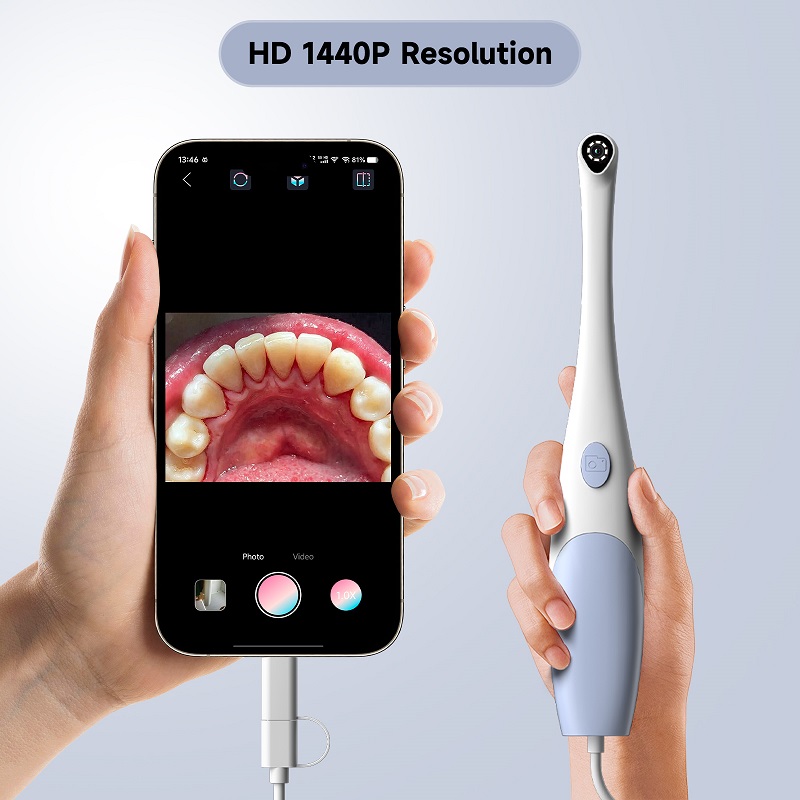 Oral Endoscope Camera 1440P Ph - Macro Photography Led Lighting 评论和价格