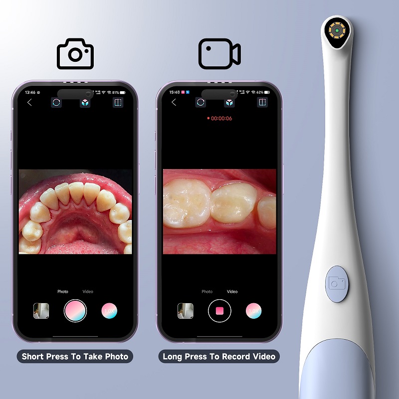 Oral Endoscope Camera 1440P Ph - Macro Photography Led Lighting 评论和价格