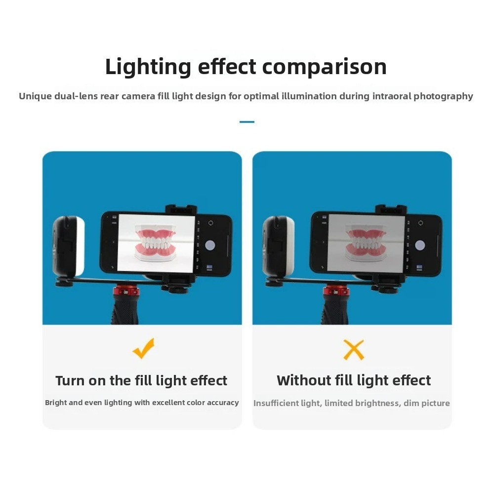 Dental Photography Light, Blue - Photography Lighting Products 评论和价格